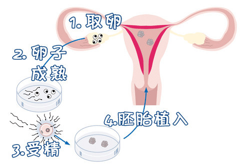 代怀双胞胎生男孩
